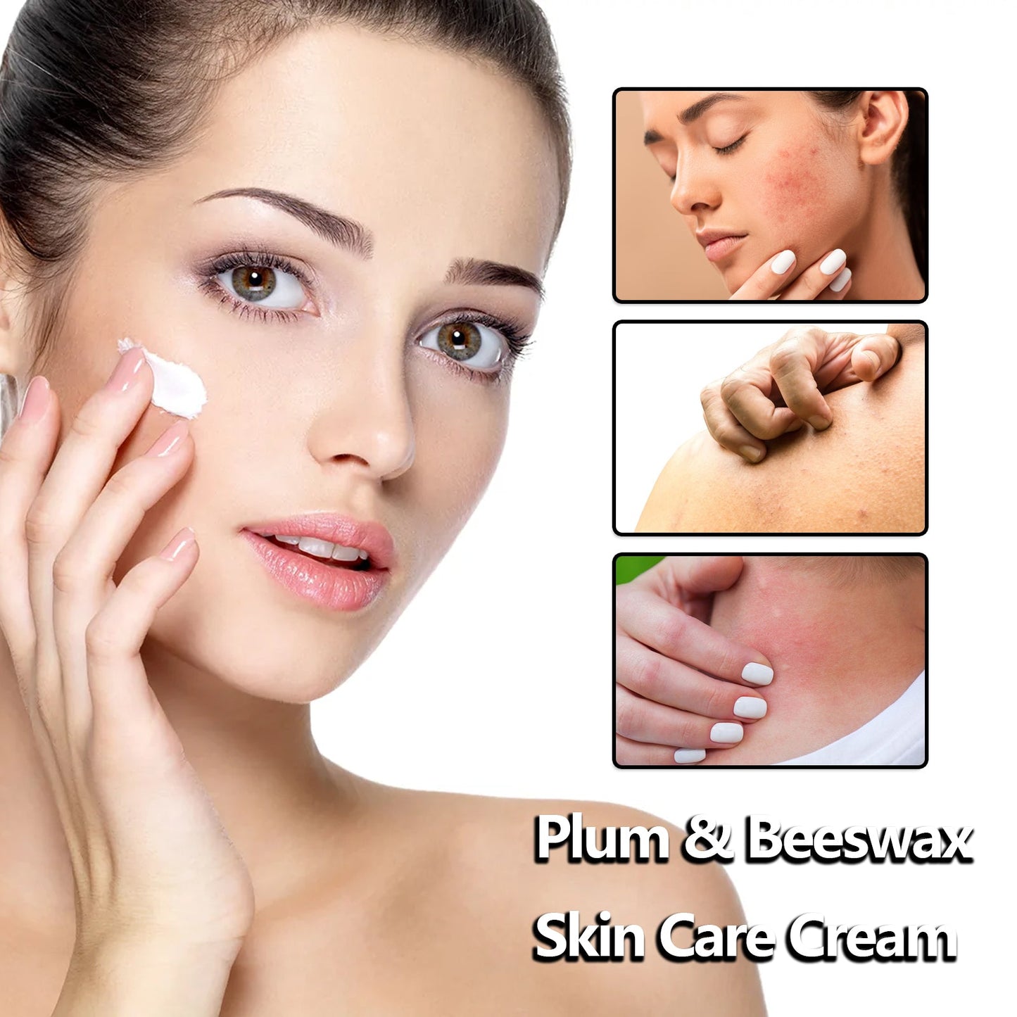 Beeswax Skin Cream Moisturizes Skin, Relieves Dry Skin, Sunburn, Mosquito Bites And Itch Relief Cream - Korvel