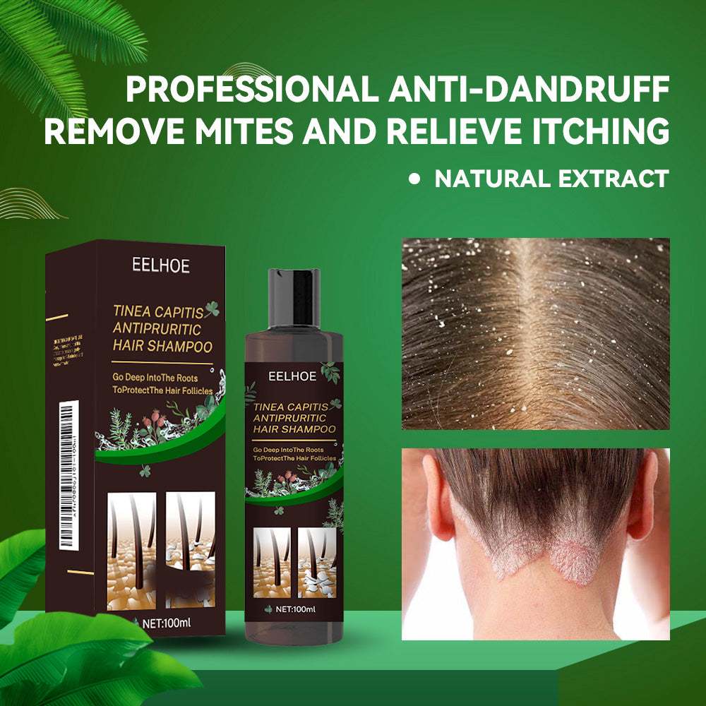 Shampoo anti-pelliculaire rafraîchissant pour des soins capillaires sains