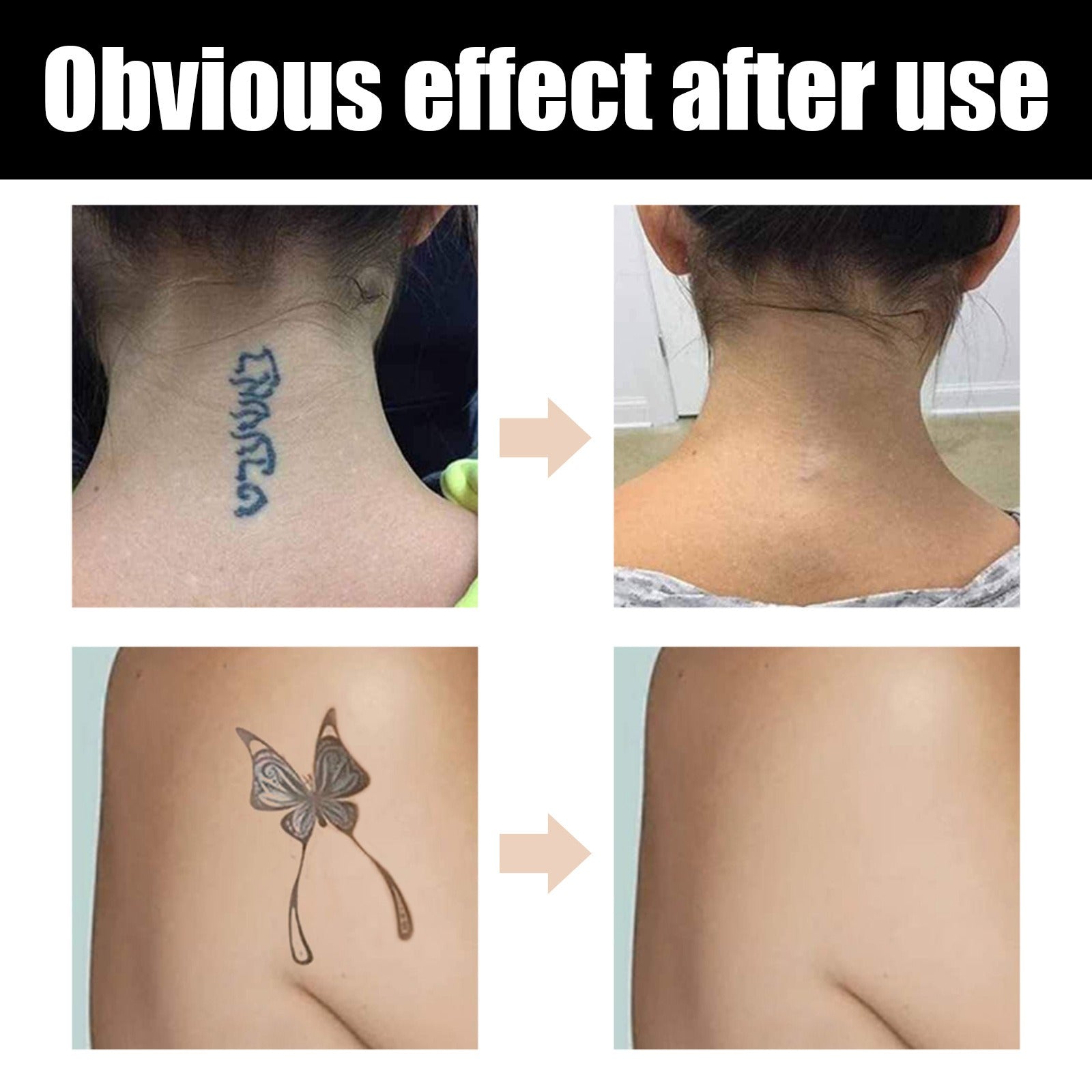 EELHOE Tattoo concealer waterproof brightening cover tattoo scar birthmark scar invisible two-color concealer - Korvel