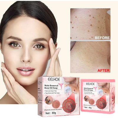 Verruca Rose Essential Oil Soap Body Cleaning Nevus Verruca Face And Neck Silk Verruca Essence Soap - Korvel