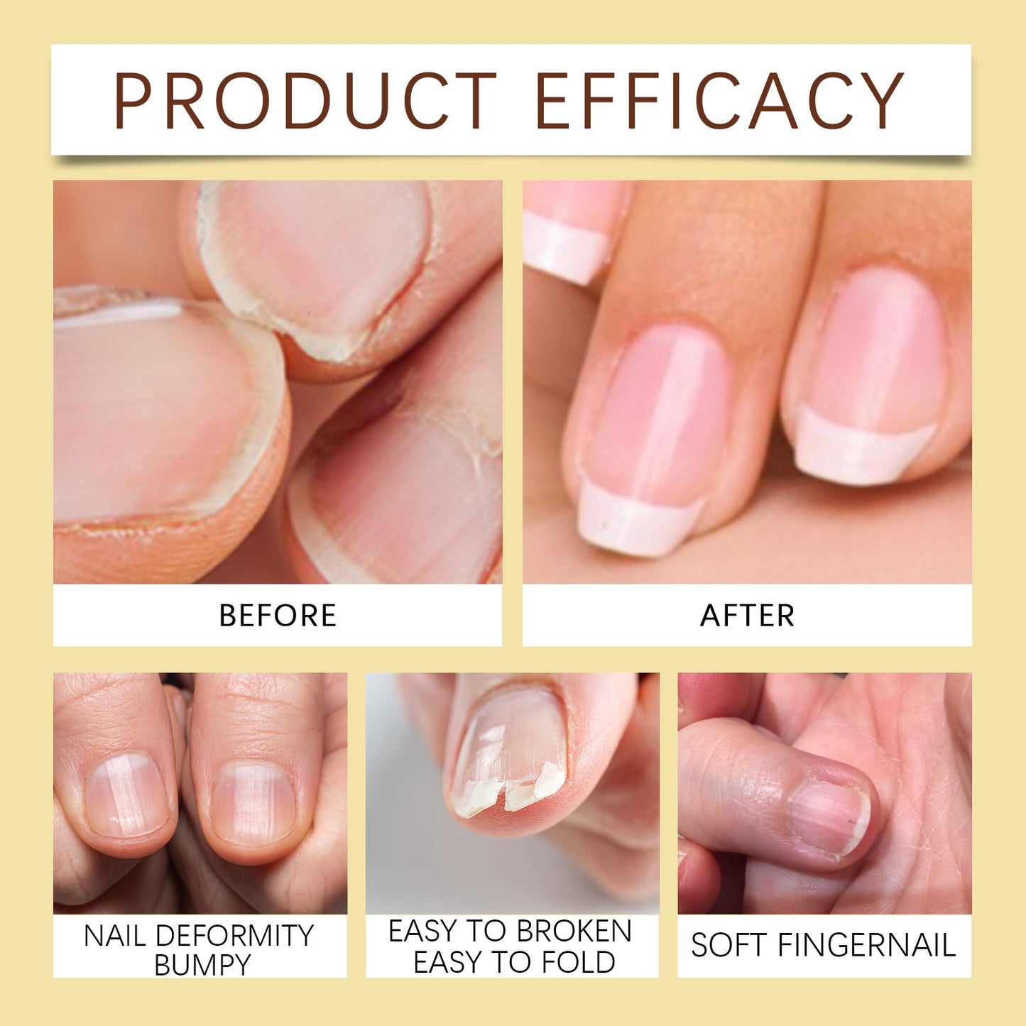 Jojoba Oil for Nails - Nourishing Nail Care Base Oil