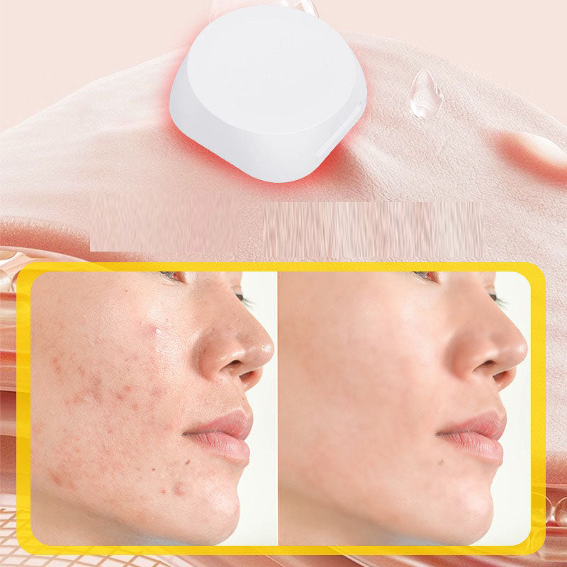 Electronic acne patch with red and blue light buttons acne removal patch with acne print water-based gel acne cleaning patch - Korvel