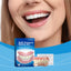 Cosmetic Denture Braces Cosmetic Dental Cosmetic Kit - Korvel