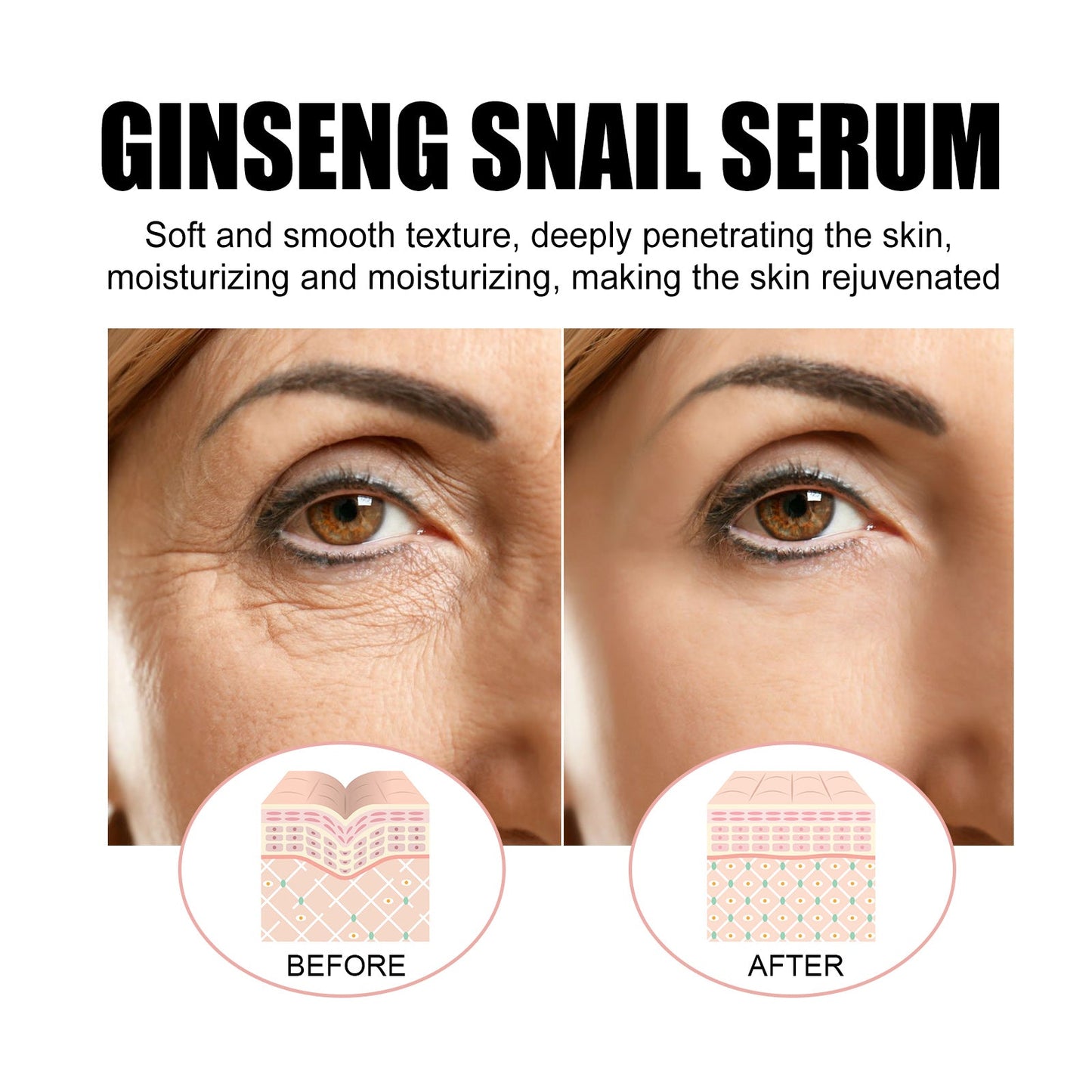 Ginseng Snail Essence, Brightening Skin Moisturizing And Repairing Dull Skin And Anti-wrinkle Essence - Korvel