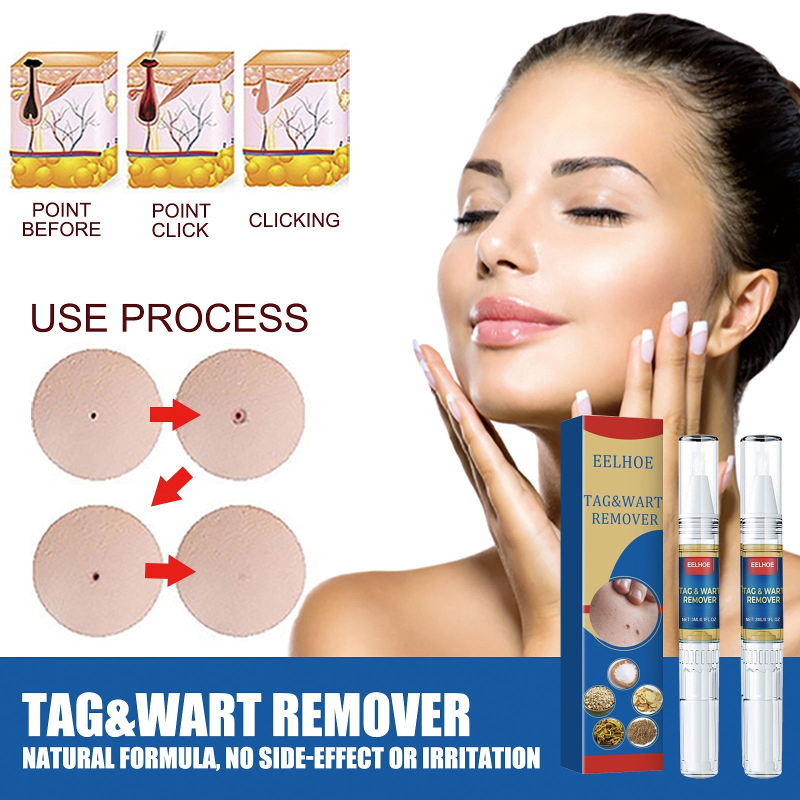 Skin Kayo Pen Gentle Body Tag Remover Cleansing Skin Care Pen - Korvel