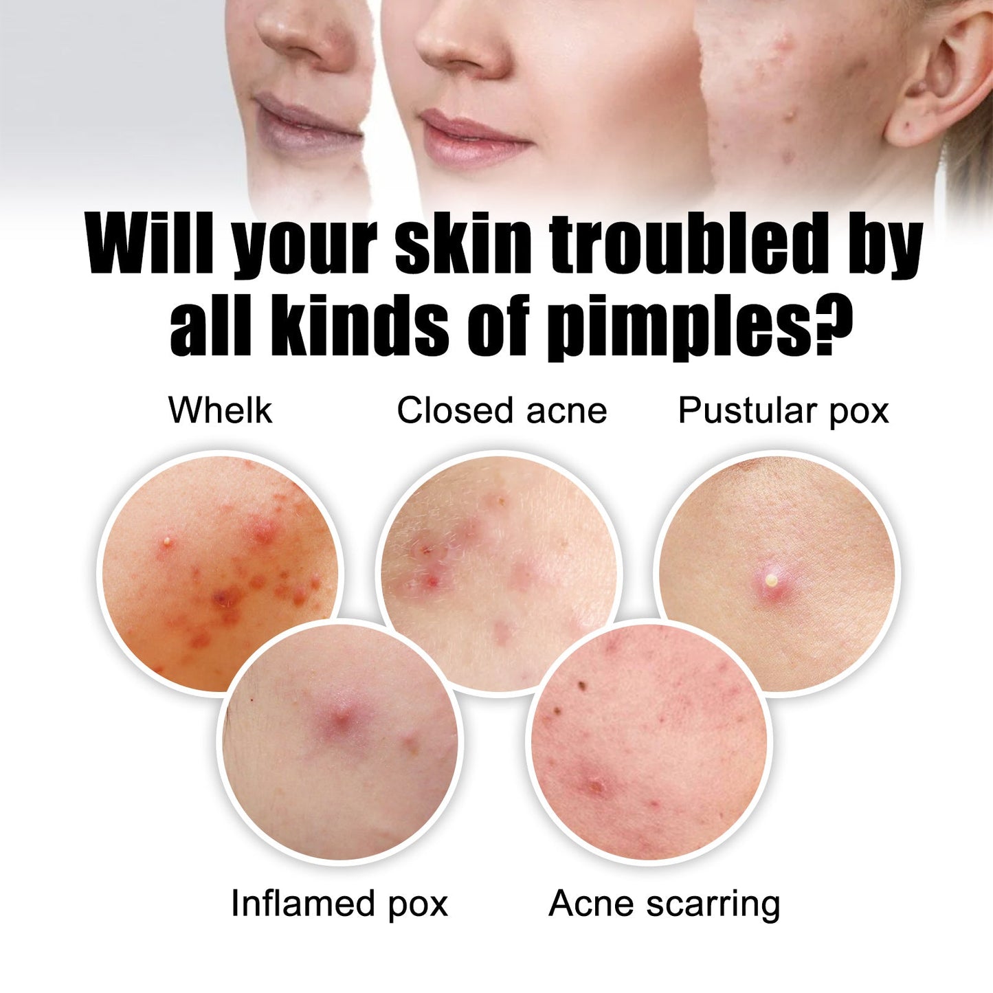 Invisible Acne Defense Patch - Color Profile Shaped