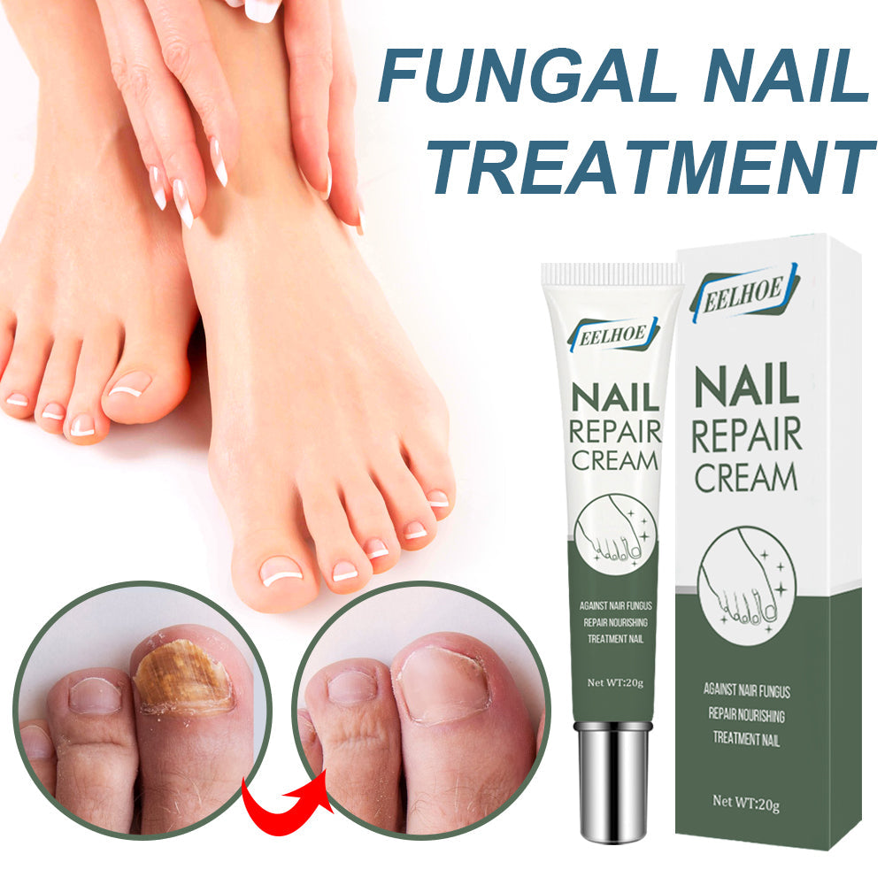 Crema Reparadora de Uñas Premium para el Cuidado de los Pies