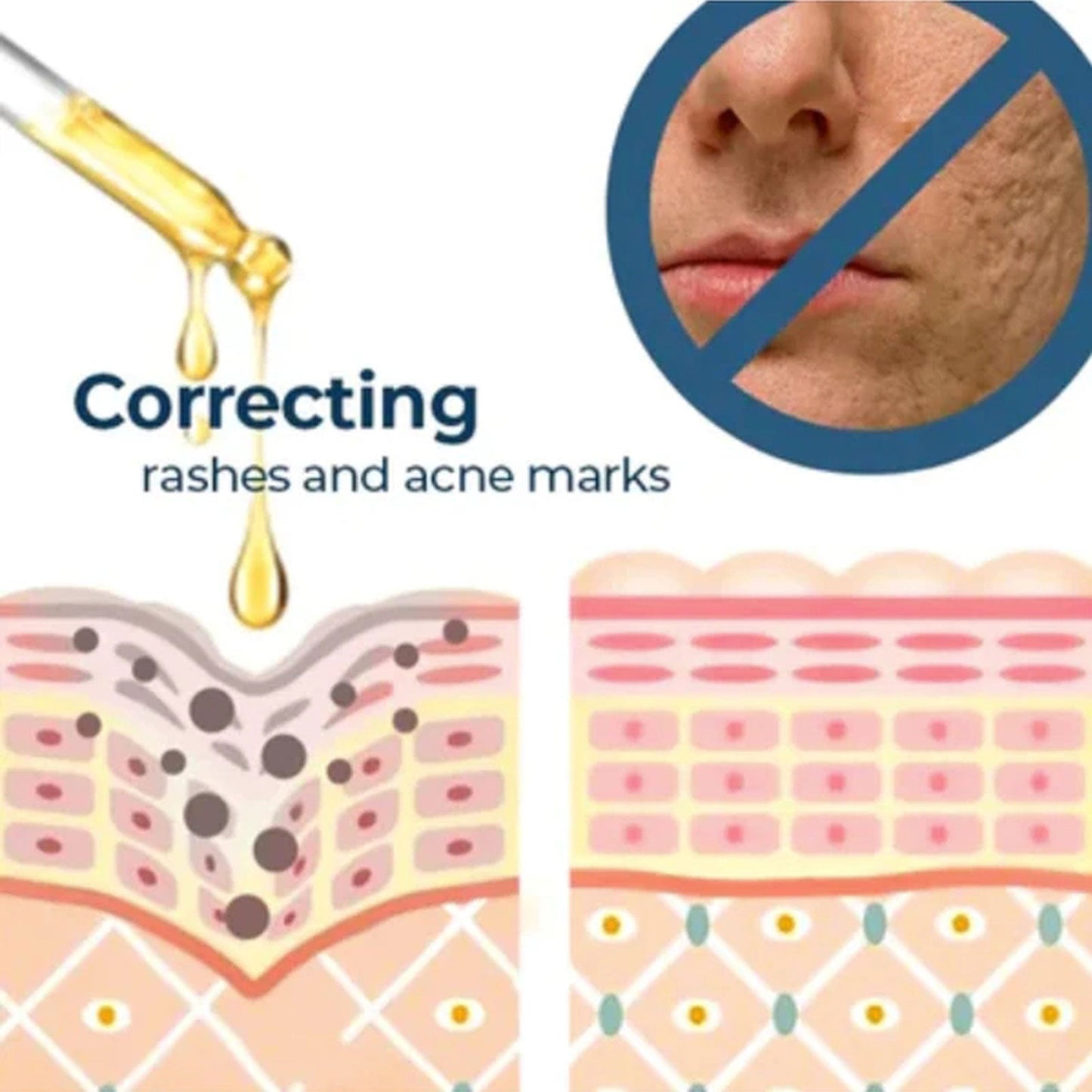 Turmeric Whitening Spot Serum, Lighten Freckle Spots Brightening Skin Hydrating Serum - Korvel