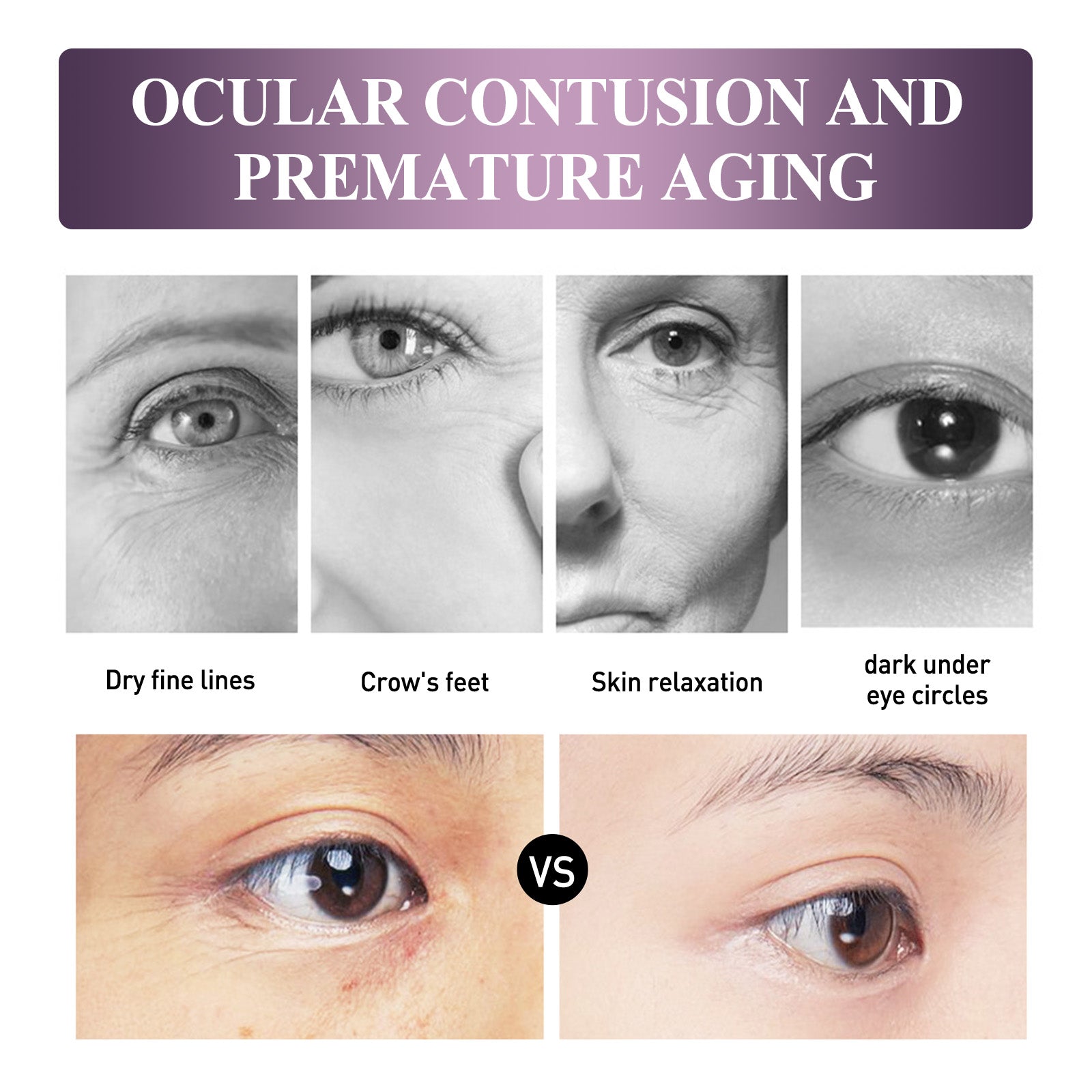 Electric Anti-Wrinkle Eye Cream Lifts, Strengthens, Moisturizes And Reduces Fine Lines, Bags And Dark Circles Under Eye Care - Korvel