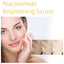 HOYGI Niacinamide Brightening Serum, Lightening Spots And Fine Lines Brightening Skin Hydrating Moisturizing Facial Treatment - Korvel