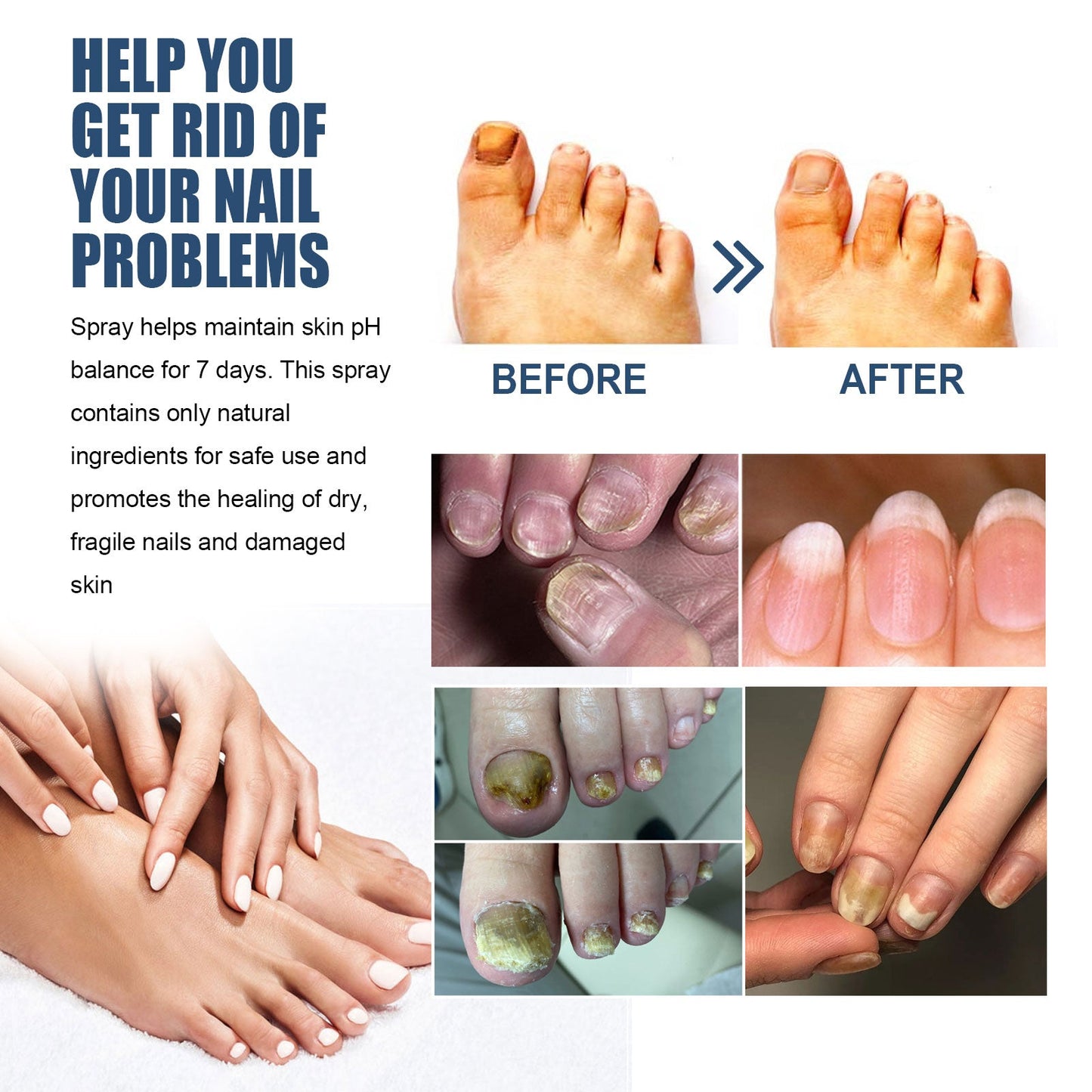 Moisturizing Nail Care Spray for Brightening Foot Nails