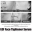 Egf Face Tightener Serum, Lighten Fine Lines Deep Hydrating Firming And Moisturizing Facial Essence - Korvel
