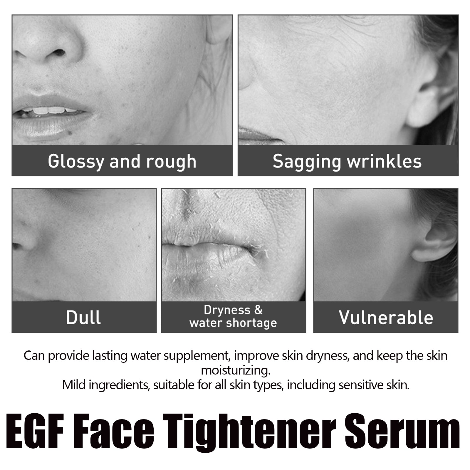 Egf Face Tightener Serum, Lighten Fine Lines Deep Hydrating Firming And Moisturizing Facial Essence - Korvel