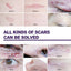 Silicone Scar Patch, Reduces Stretch Marks And Hyperplasia Of Caesarean Section Scars Silicone Patch - Korvel