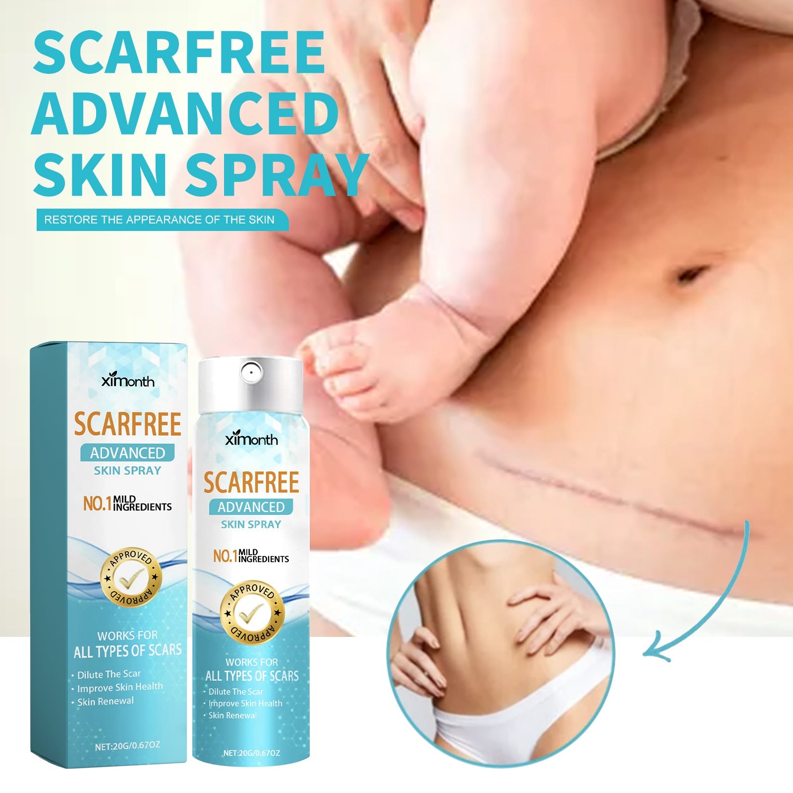 Scarfree Advanced Skin Spray, Body Skin Care Reduces Post-Natal Scars And Smooths Skin - Korvel