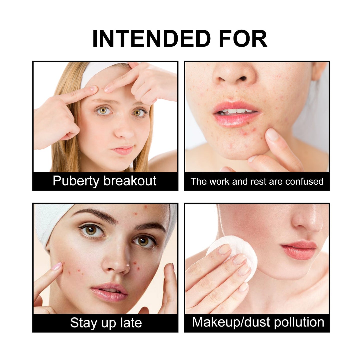Patch anti-acné noir mignon JAYSUING pour soins de la peau