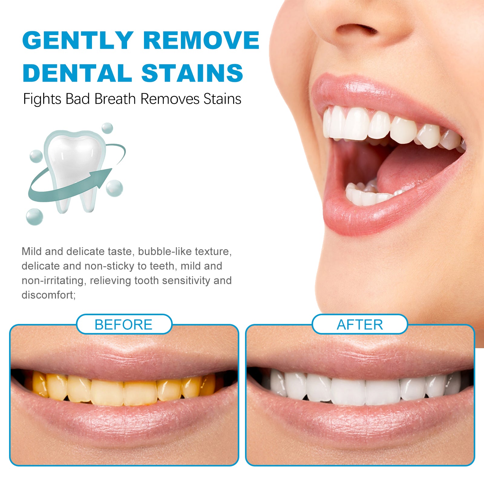 Mouth Mousse Toothpaste Teeth Clean Teeth Remove Tartar Stains Yellow Teeth Whitening Teeth Fresh Breath - Korvel