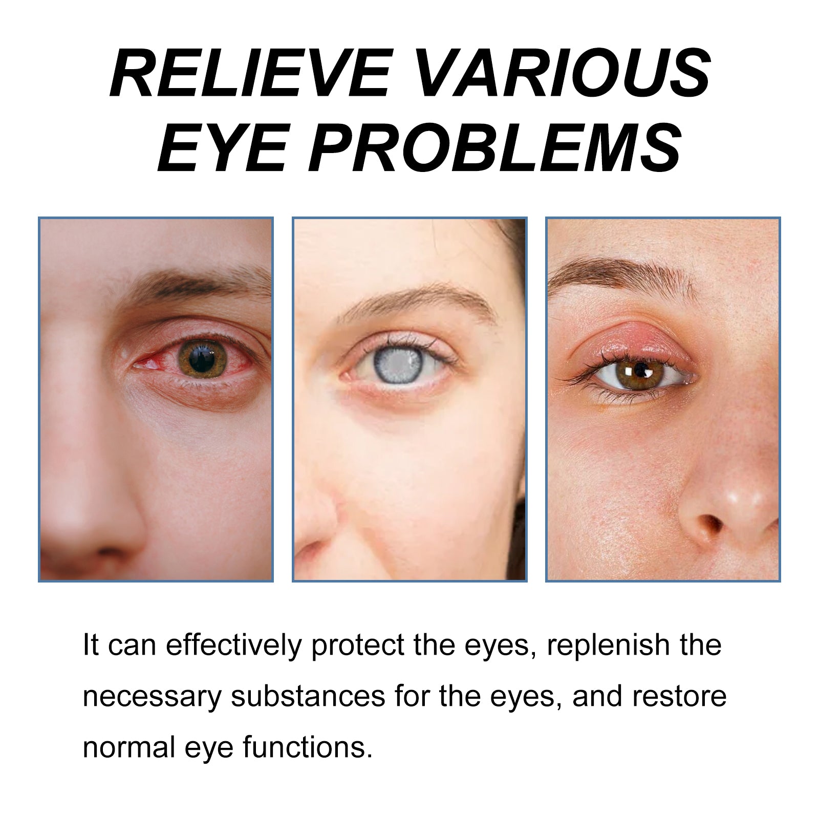 Myopia Reversal Eye Drops, Relieve Eye Discomfort Repair Eye Fatigue And Dry Eye Moisturizing Lotion - Korvel