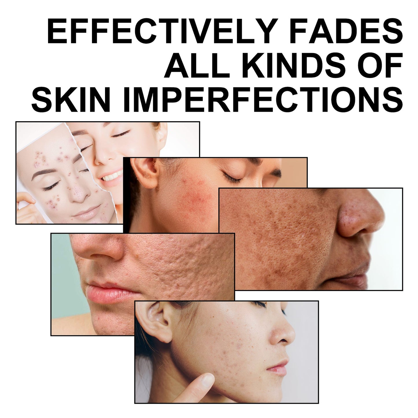 Multi Function Face Serum, Moisturize And Soften Fine Lines And Wrinkles - Korvel