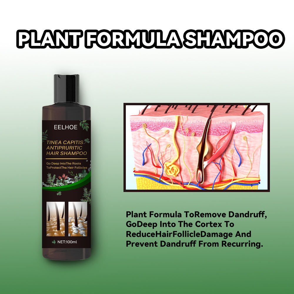 Shampoo anti-pelliculaire rafraîchissant pour des soins capillaires sains