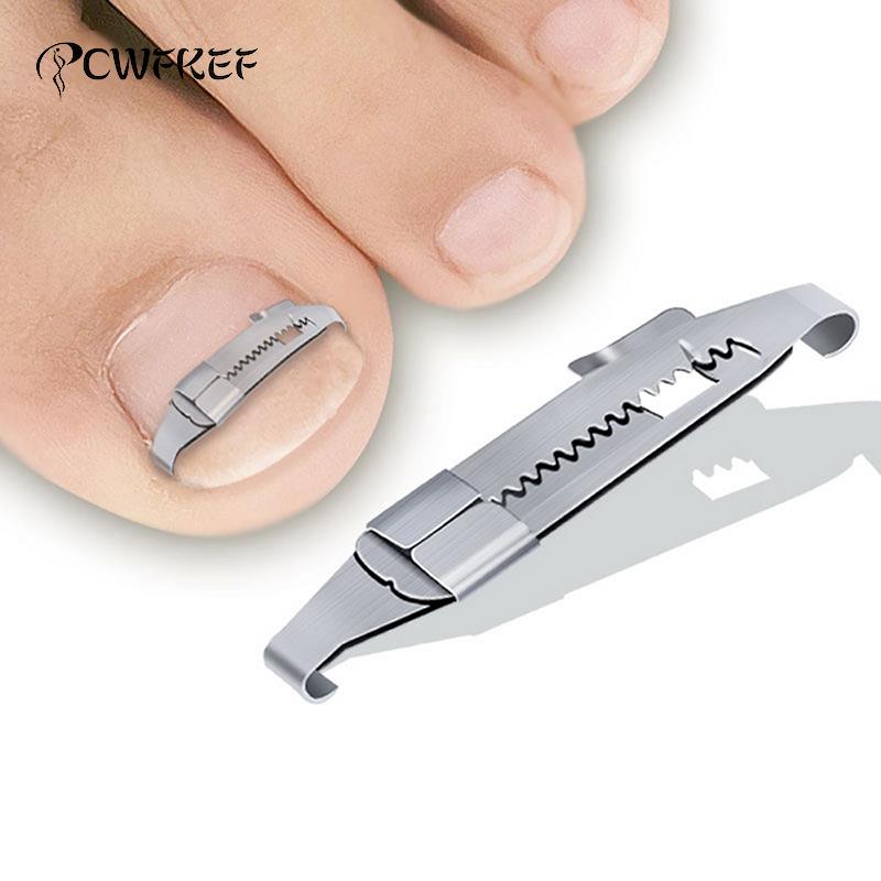 Ingrown Toenail Corrector Tools Pedicure Recover Embed Toe Nail Treatment Professional Ingrown Toenail Correction Foot Care Tool - Korvel