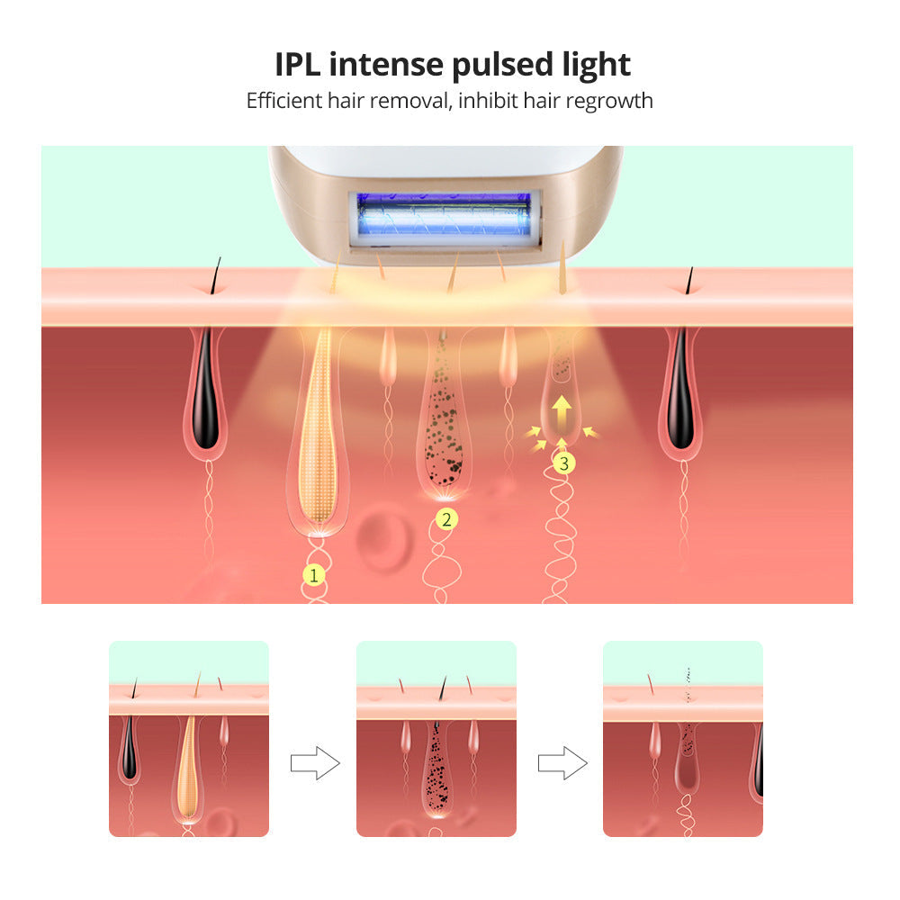 Dispositivo de depilación IPL premium con tecnología de detección de hielo