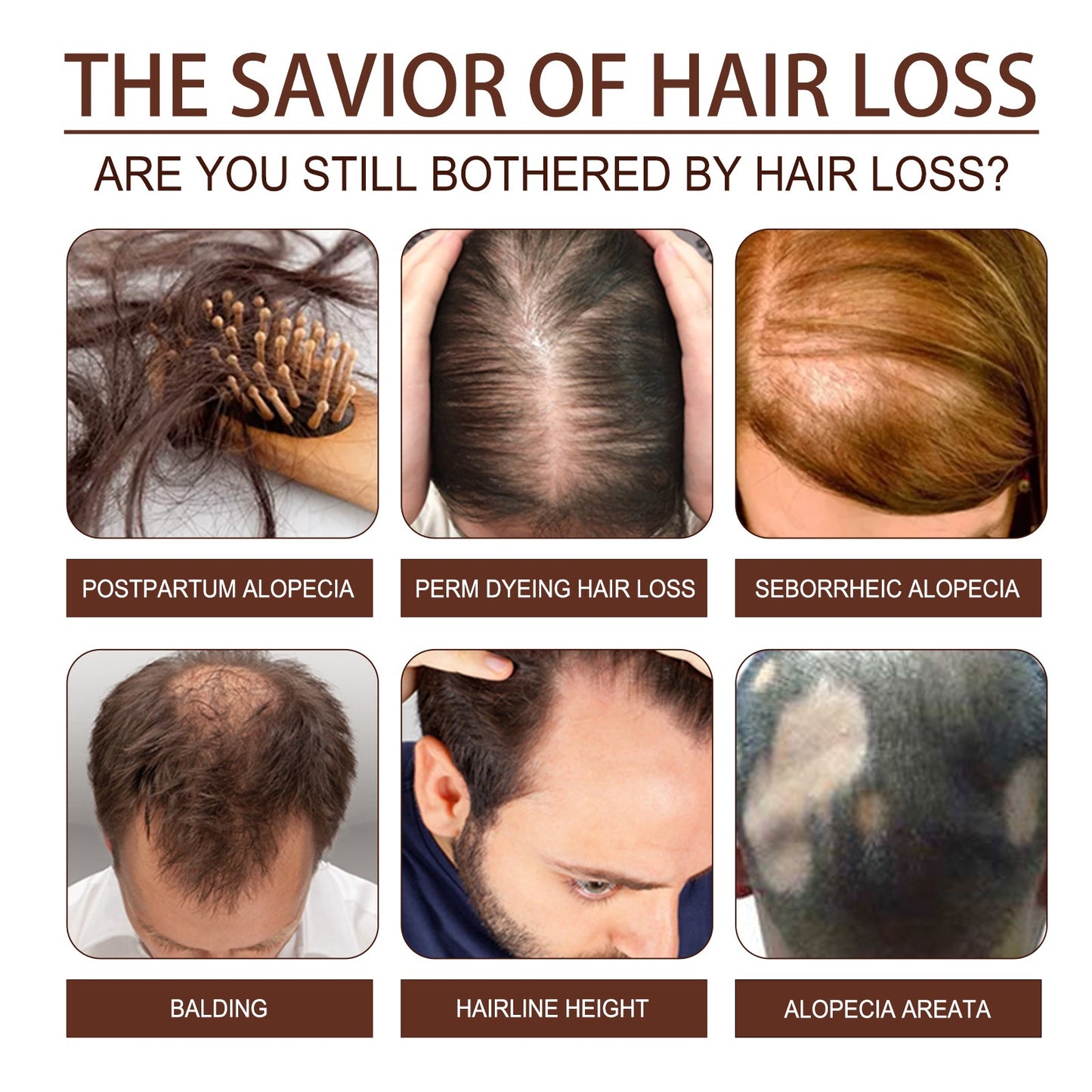 Castor Oil Hair Dense Essential Oil Repair Damaged Hair, Nourish Scalp, Strengthen Hair And Prevent Hair Loss - Korvel