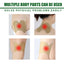 Knee Relief Patches Kit for Comfort and Support