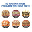 Dental pencil Teeth Cleaning Remove Dirt And Yellow Smoke Teeth Brightening Whitening Oral Cleaning Pen - Korvel