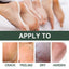 Anti-Crack Hand And Foot Care Cream Moisturizes Skin To Prevent Dry Cracking, Peeling, Freezing And Chapping - Korvel