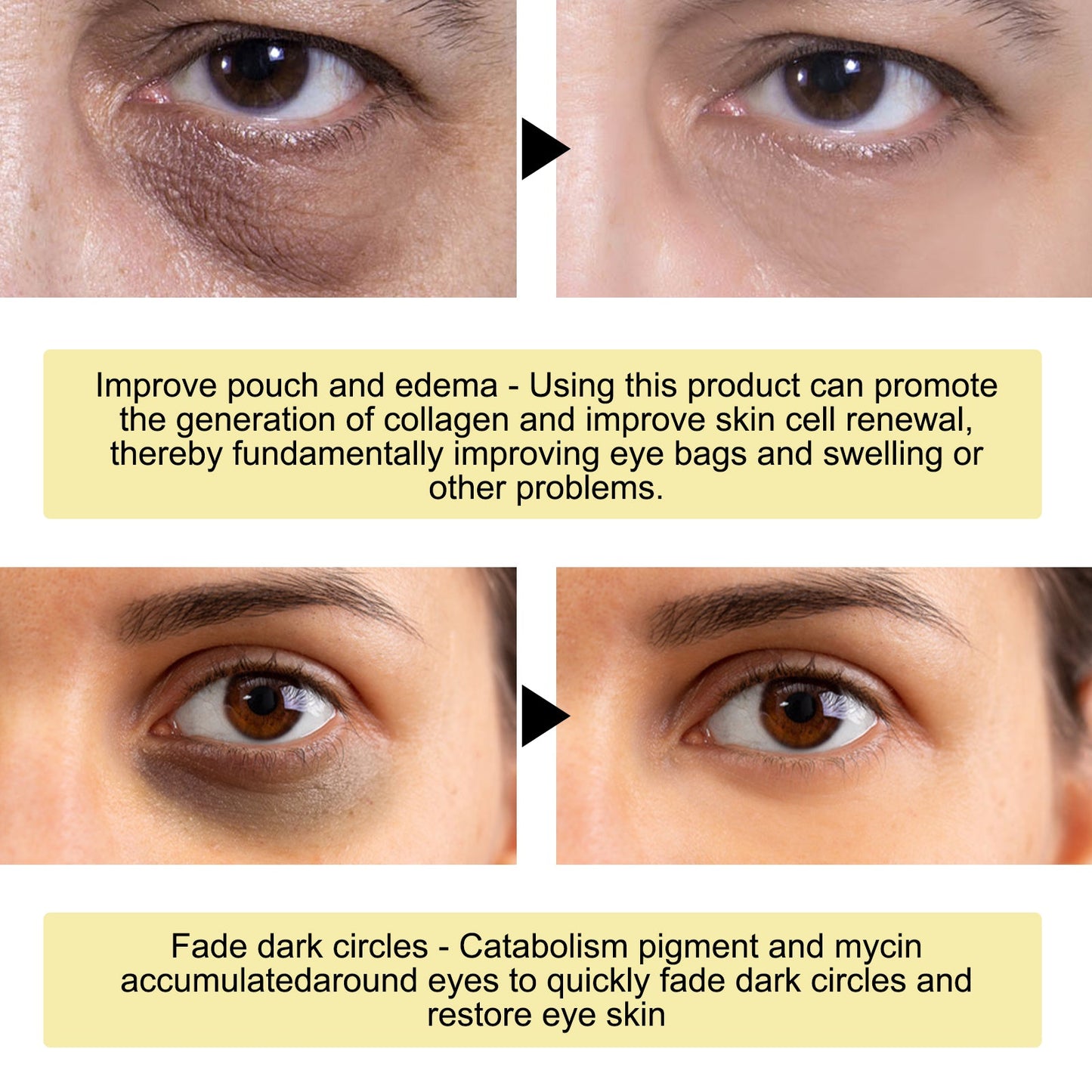 Mascarilla de Ojos de Colágeno de Caracol Dorado para Hidratación y Firmeza