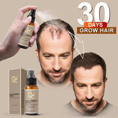 Purc Natural Ginger Essence Hair Growth Spray - 30ml