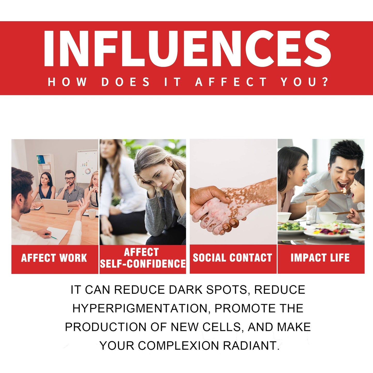 Dark Spot Whitening Cream, Lightening Yellow Brown White Spot Cream Dark Spots Correct Skin Tone Moisturize Skin Whitening - Korvel