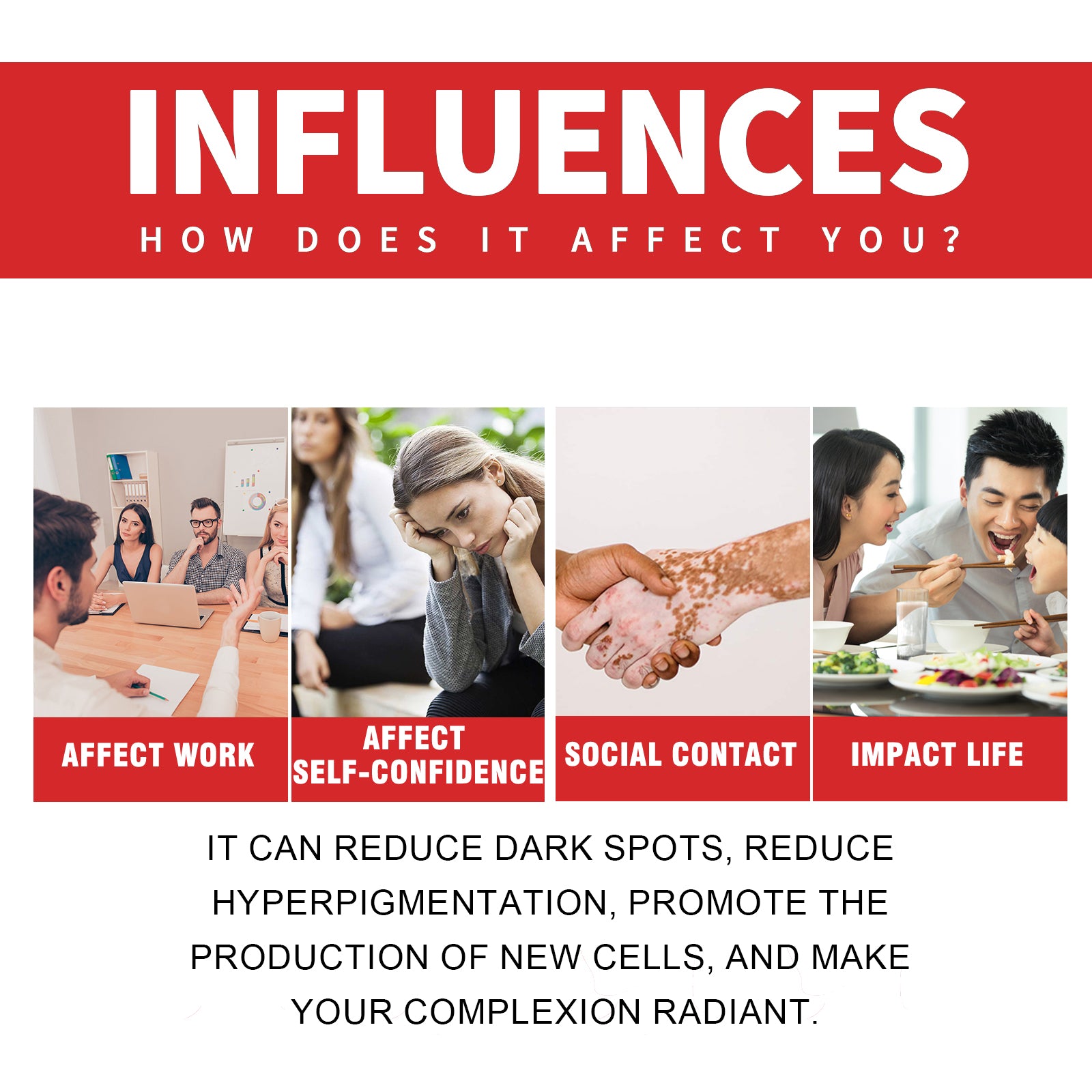 Dark Spot Whitening Cream, Lightening Yellow Brown White Spot Cream Dark Spots Correct Skin Tone Moisturize Skin Whitening - Korvel