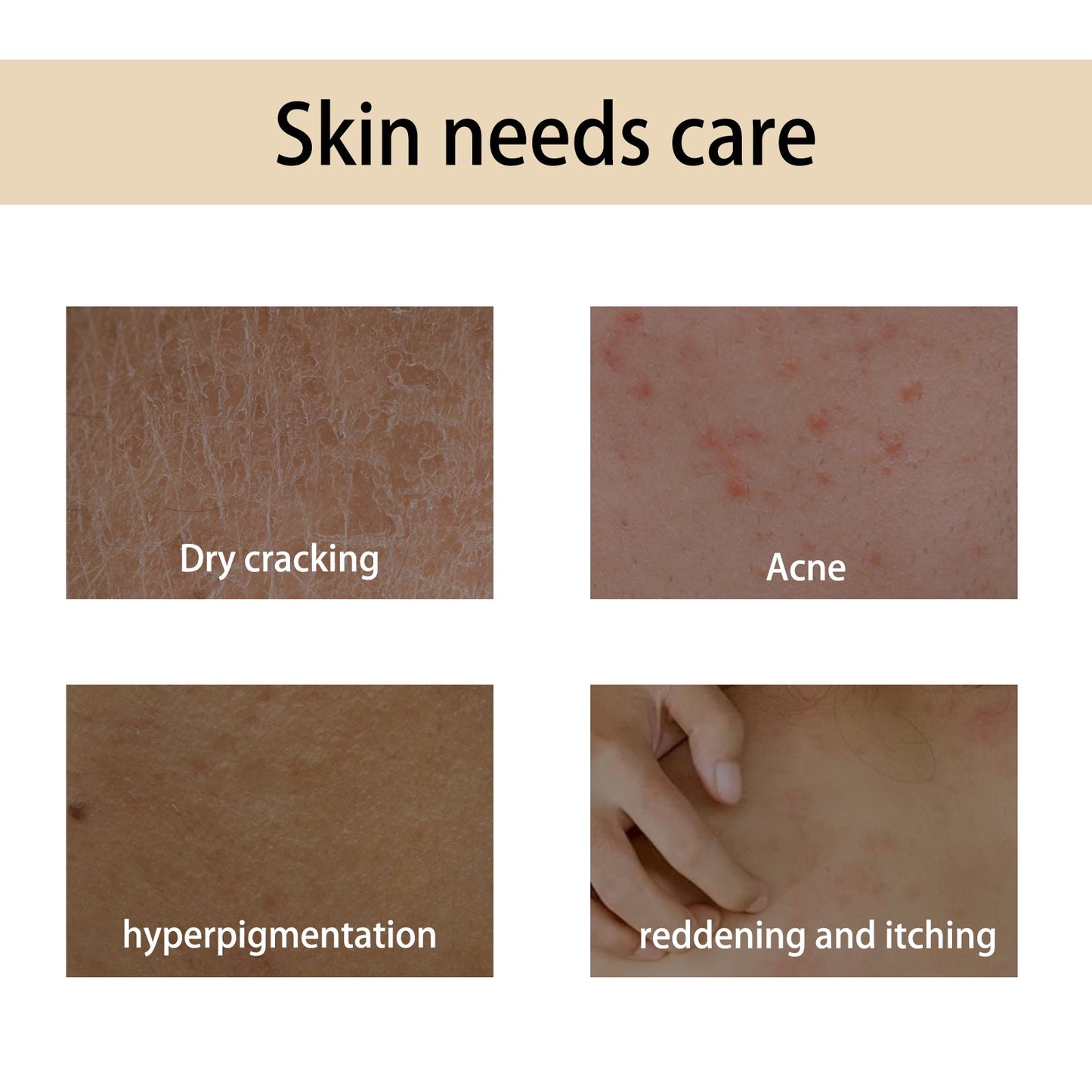 Handcrafted Body Oil, Body Massage Moisturizing Firming And Tender Skin Care Essential Oil - Korvel