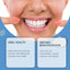 Modified Teeth Dentures American Dentures Modified Teeth Interdental Orthodontic Dentures - Korvel