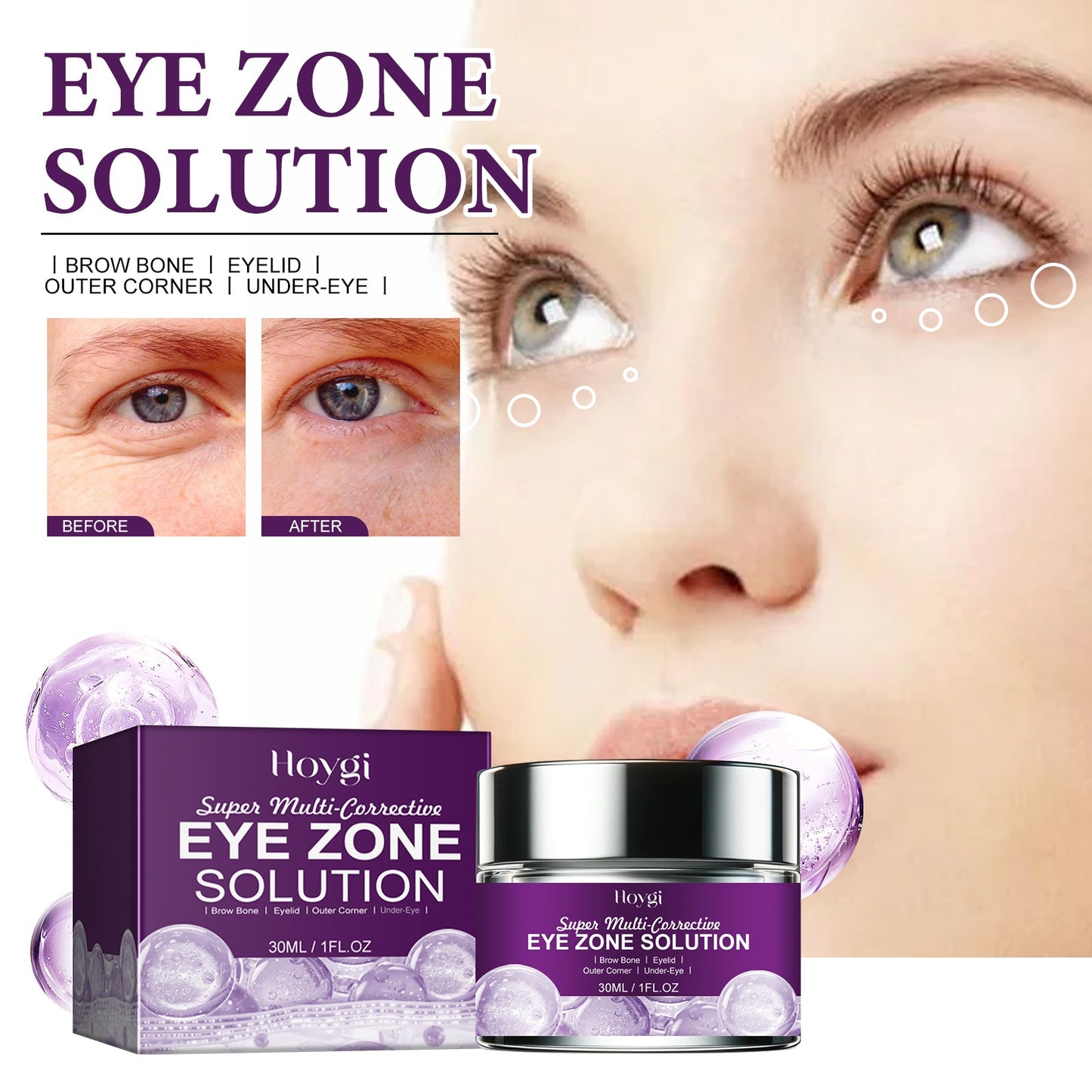 Eye Zone Solution, Niacinamide Moisturizing And Firming Eye Anti-Aging Eye Cream - Korvel
