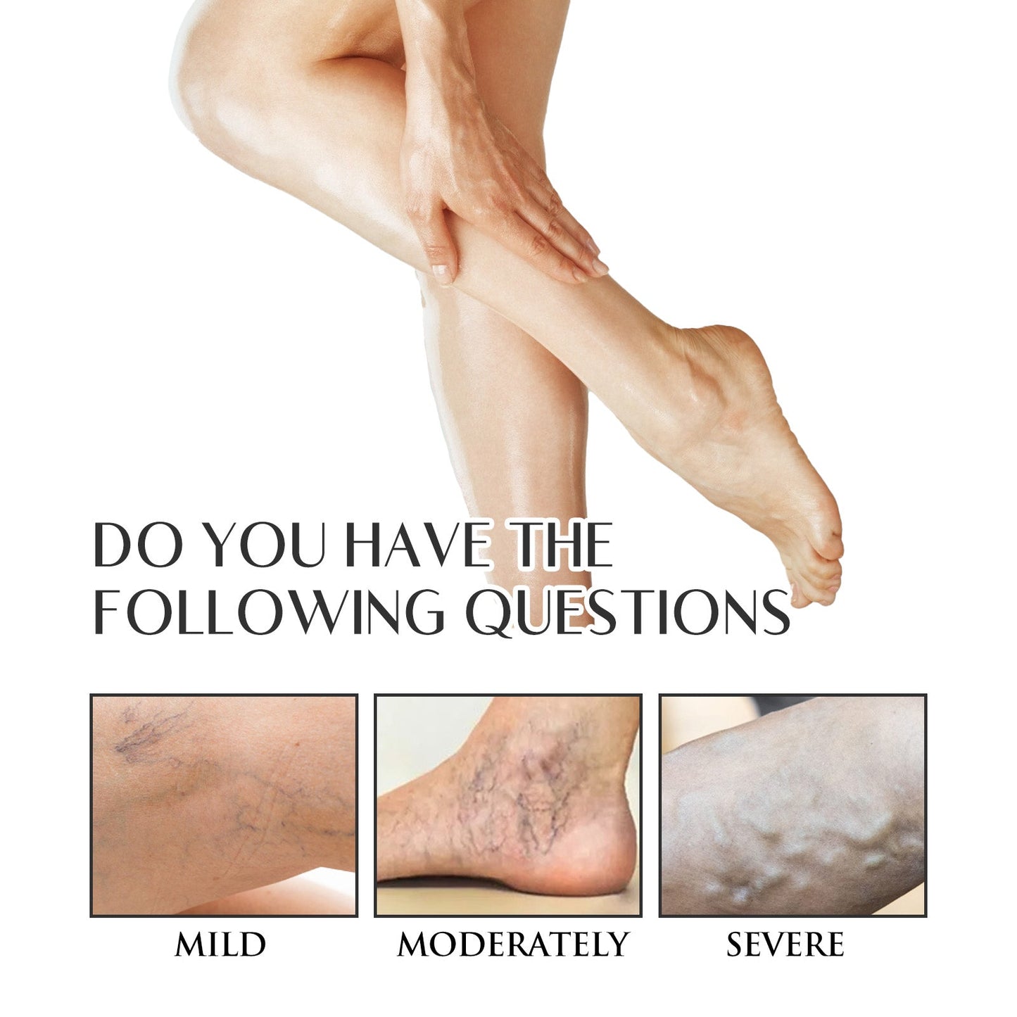 Varicose Veins Soothing Spray, Relief Of Sore Leg Muscles Massage Repair Earthworm Leg Vein Treatment Spray - Korvel