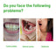 Herbal Oral Repair Foam, Deep Cleaning tartar Stone Fresh Breath Whitening teeth Oral mousse - Korvel