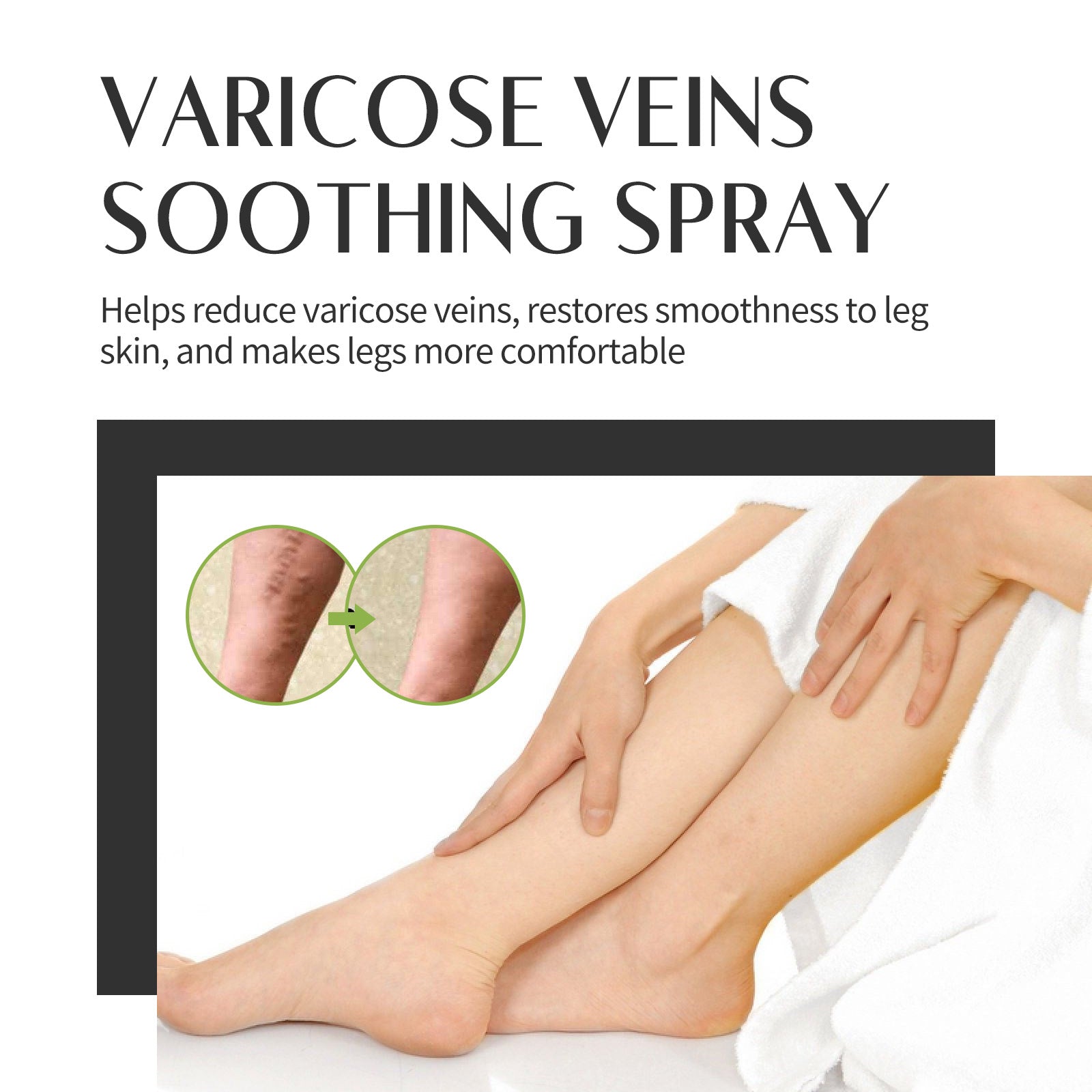 Varicose Veins Soothing Spray, Relief Of Sore Leg Muscles Massage Repair Earthworm Leg Vein Treatment Spray - Korvel