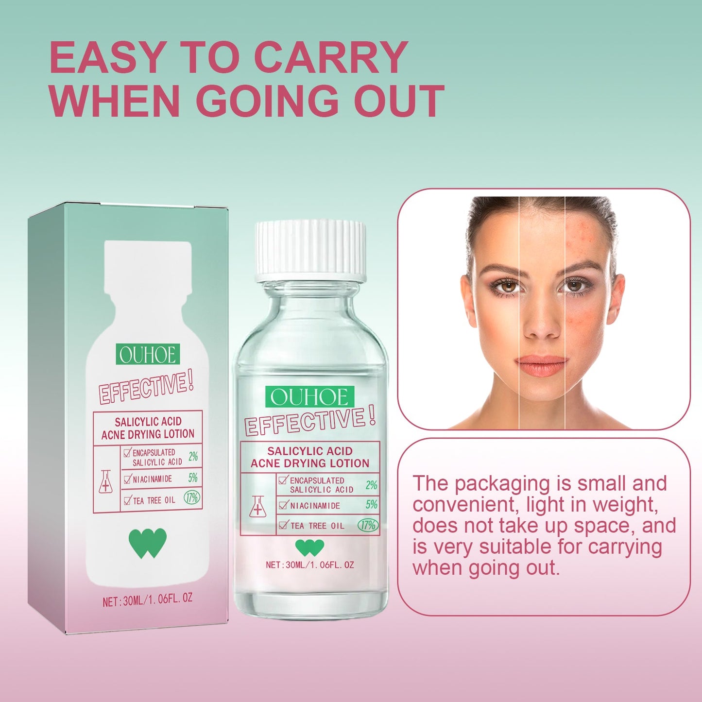 Salicylic Acid Acne Drying Lotion, Gentle Repair Acne-Skin Skin Moisturizing Lotion - Korvel