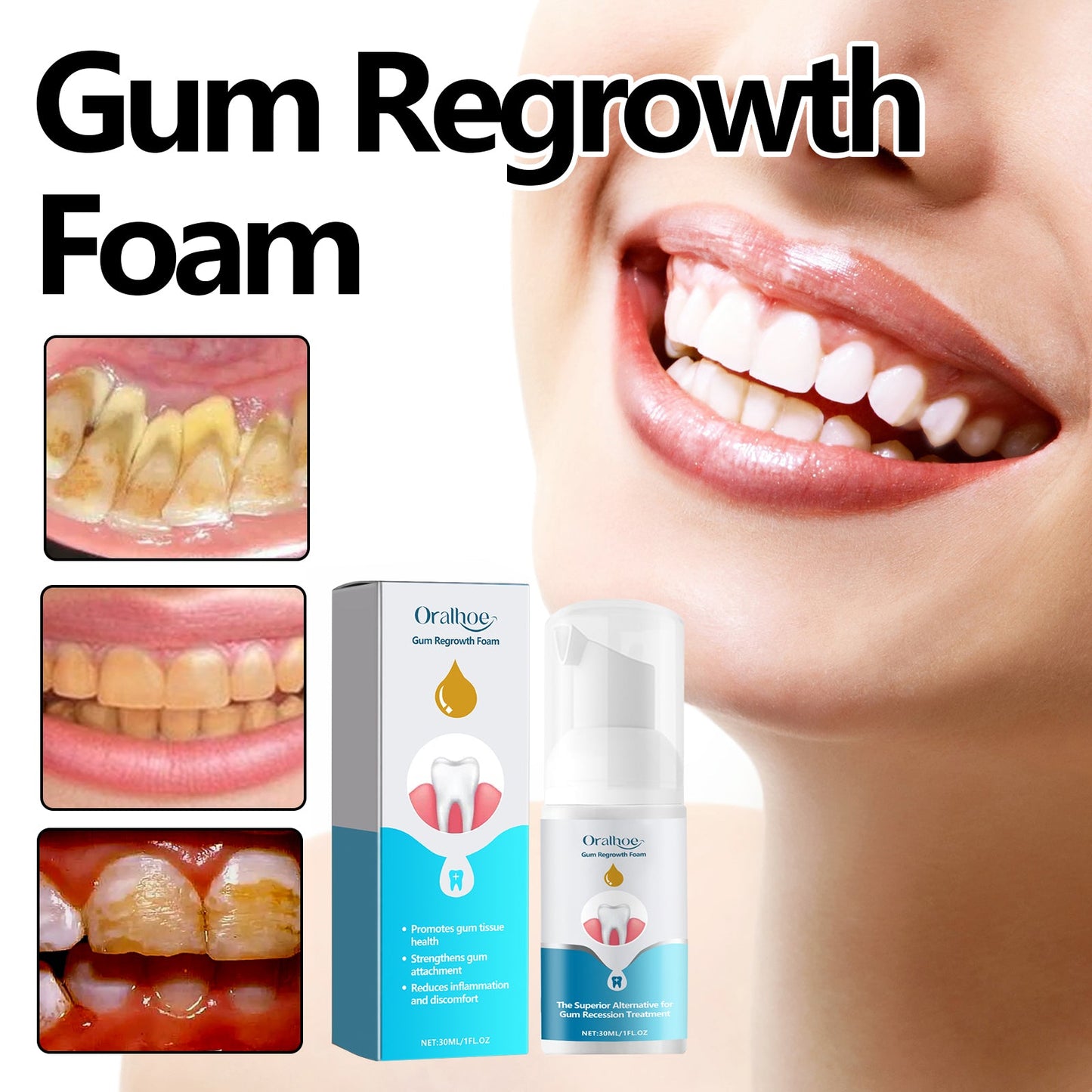 oralhoe Gum Regrowth Foam, Clean Teeth Tartar Care Gums Clean Teeth Anti-Moth Fresh Breath Mousse - Korvel