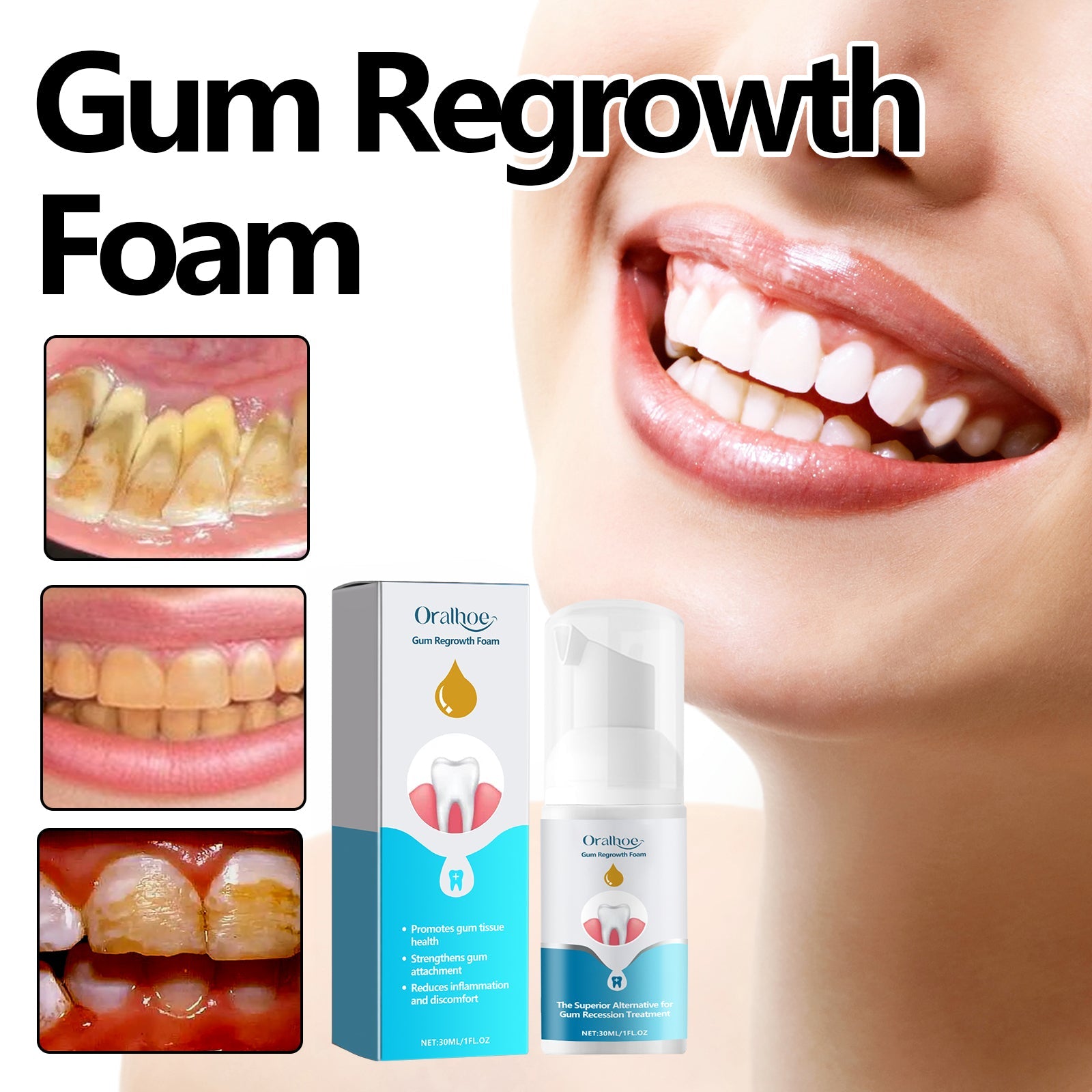 oralhoe Gum Regrowth Foam, Clean Teeth Tartar Care Gums Clean Teeth Anti-Moth Fresh Breath Mousse - Korvel