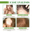 Aceite Esencial para el Cuidado del Cabello - Hidratante y Protector