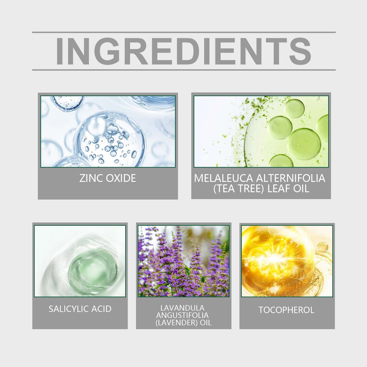 Refreshing Oil Control Acne Cream for Soothing Care