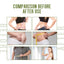 Body Body Suction, Light Body Body Firming Small Belly Bairn Meat Show Body Care Suction - Korvel