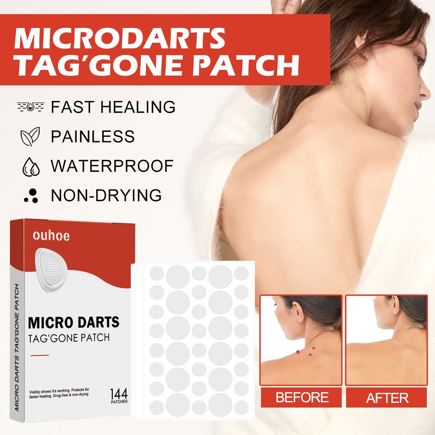 Acne Patch, Skin Clean Acne Pimple Moles Gram Wart Corns Spot Patch - Korvel