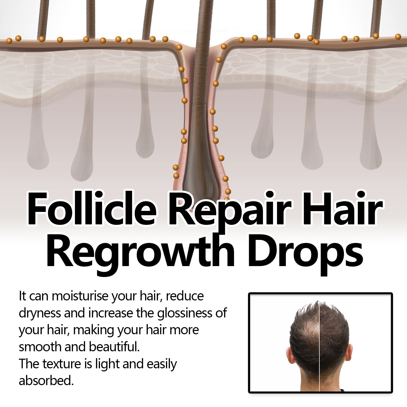 Follicle Repair Hair Regrowth Drops, Hair Protection Strong And Solid Hair Thickening Scalp Nourishing Massage Lotion - Korvel
