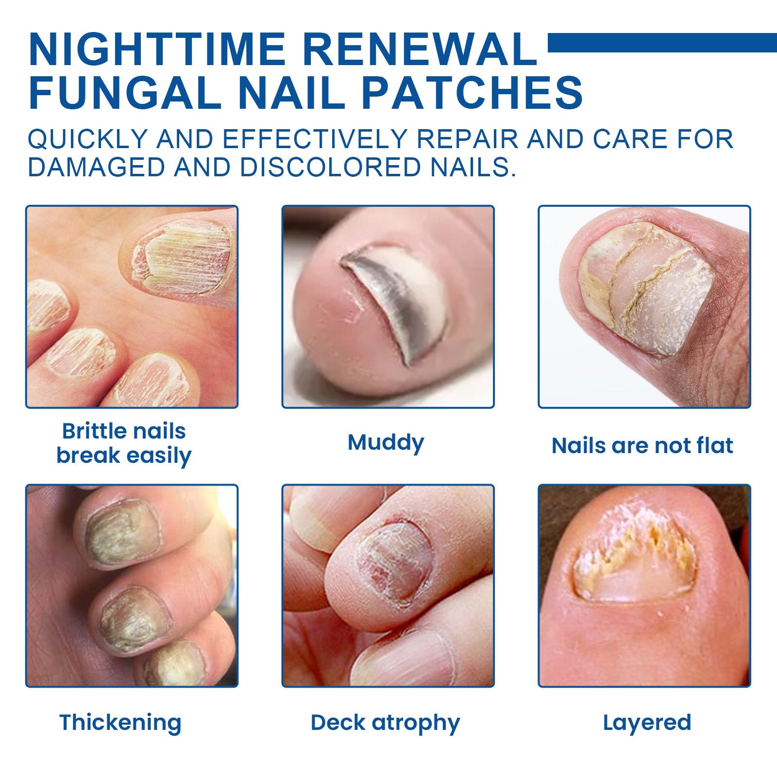 Nighttime Renewal Fungal Nail Patches, Repair And Thickening Gray Nail Insert Soft Nail Care Patch - Korvel
