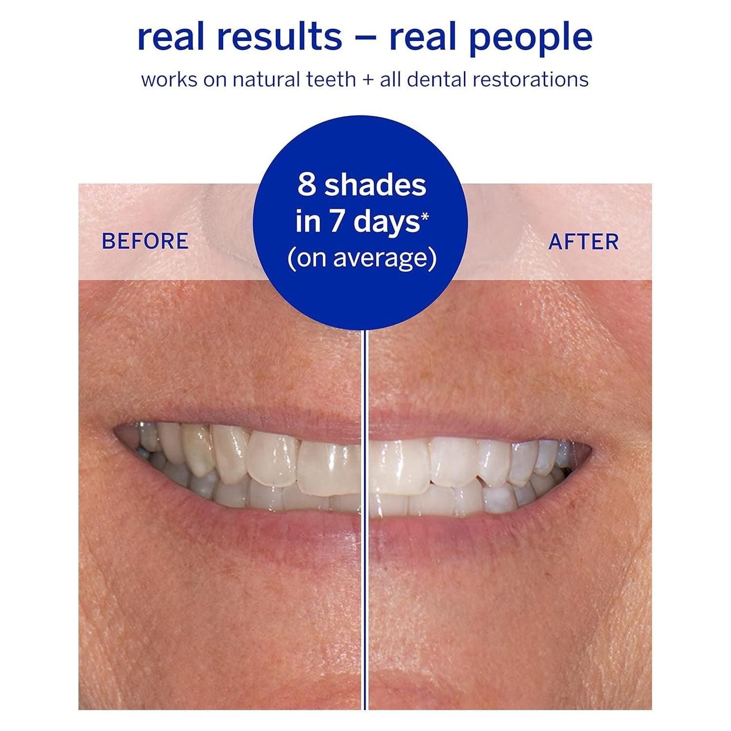 Supersmile Superstrips Teeth Whitening Dissolving Strips - 14 Count